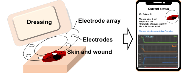 thesis on electrical impedance tomography